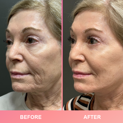 LIMETOW® Compact Anti-Wrinkle Bar💝LAST DAY 50%OFF