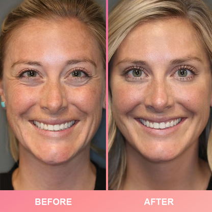 LIMETOW® Compact Anti-Wrinkle Bar💝LAST DAY 50%OFF